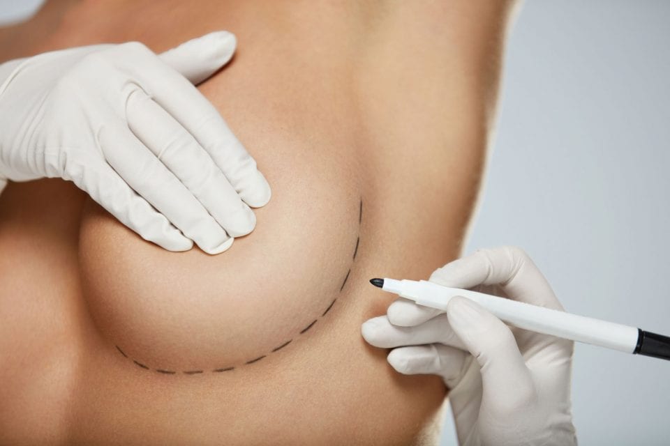 Breast Augmentation Plastic & Facial Plastic Surgery